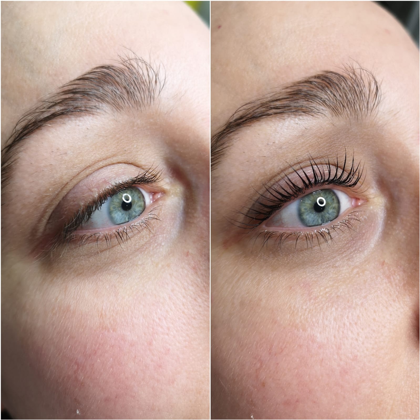 Wimpernlifting