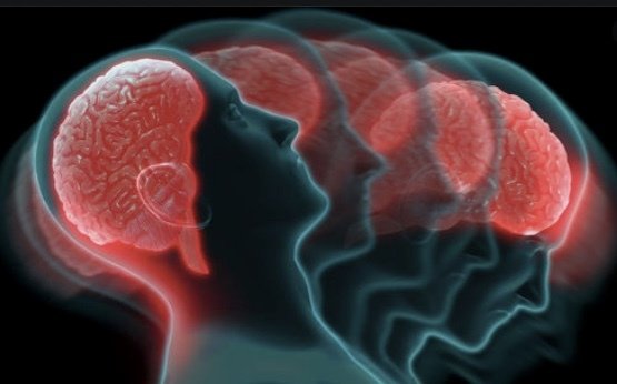 Dystonie Online - Informationen rund um die neurologische Bewegungsstörung Dystonie