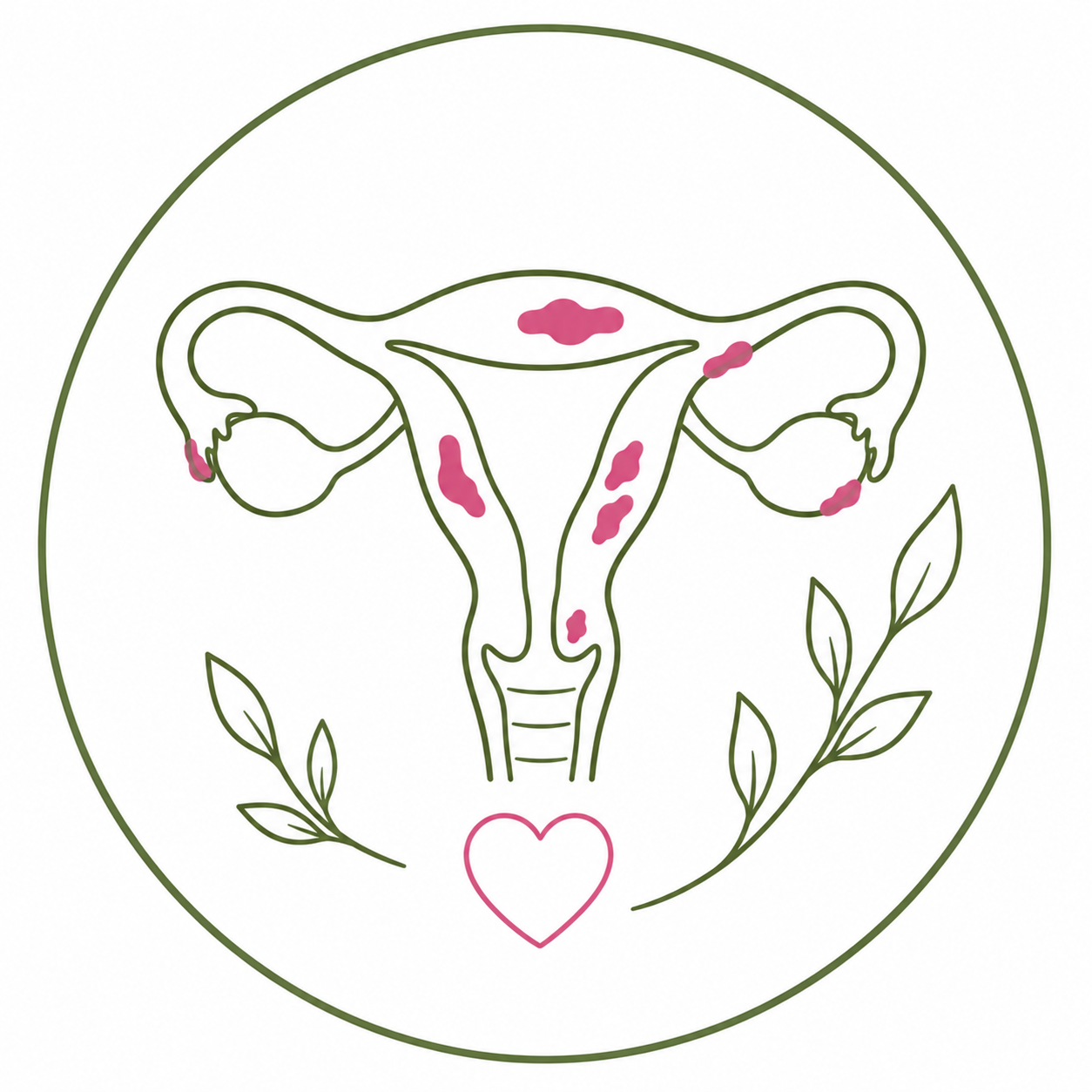 Endometriose und ganzheitliche Begleitung der Frauengesundheit