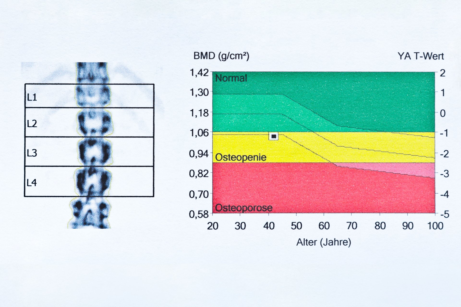 knochendichtemessung-ortho-balance