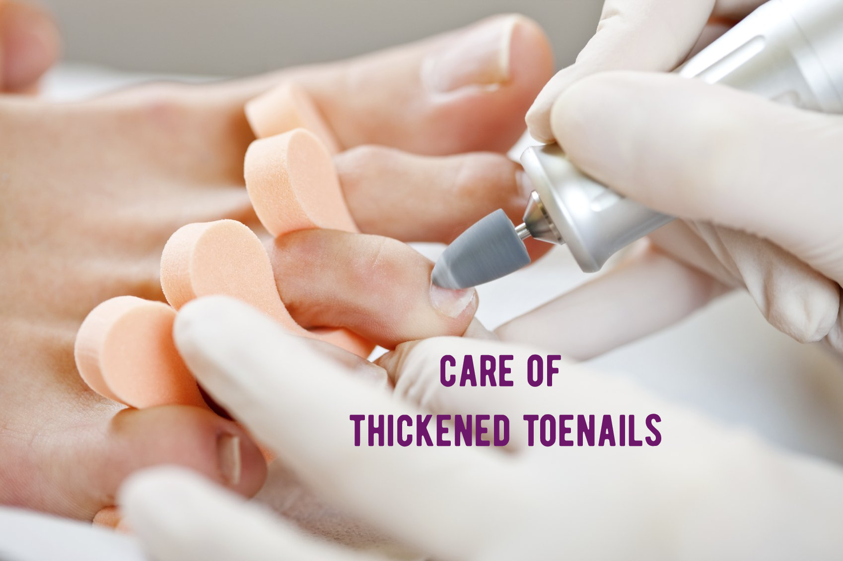 Dawe Holistic Foot Care Registered Nurse, Foot Care Nurse.