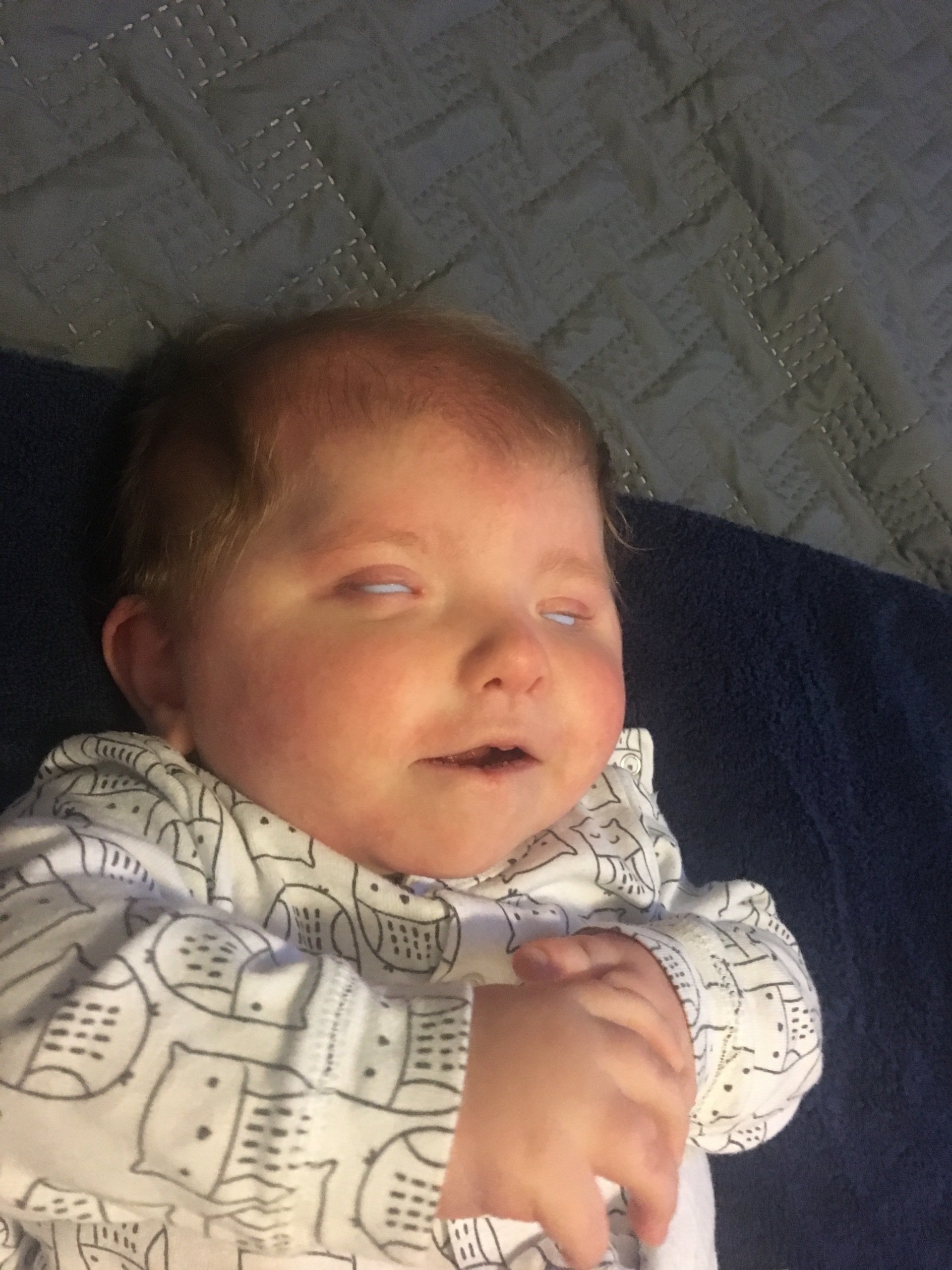 Bilateral Anophthalmia and Me BAAM