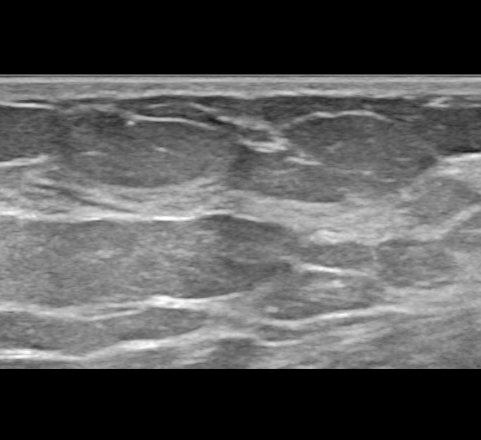 Dr. Nabielek - Ultraschallbilder - Weibliche Brust