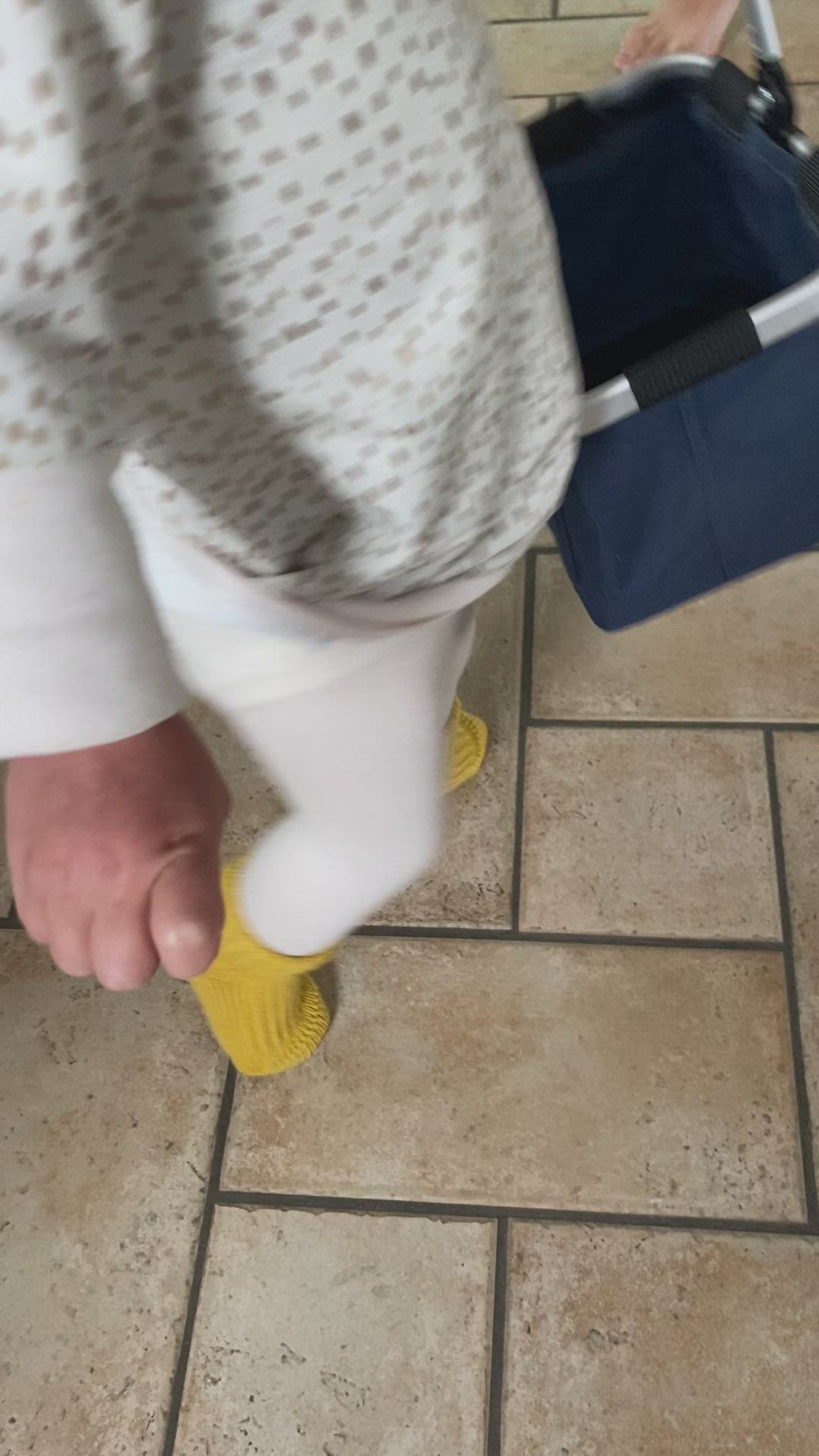 Behandlung mit Gips zum Abnehmen Behandlung mit Gips zum Abnehmen