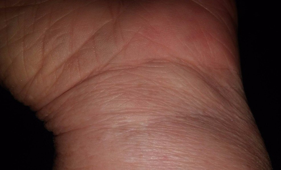 health_deteriorating