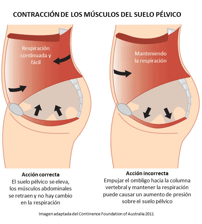 dolor pélvico y flatulencia vs dolor pélvico y flatulencia vs