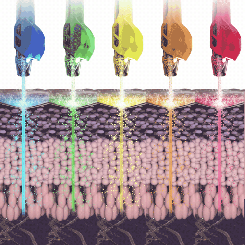 JetProDuo™ Hydroporation und Photoporation Light JetProDuo™ Hydroporation – der fein gebündelte, kollimierte Aerosolstrahl wird mit unterstützendem LED-Licht kombiniert