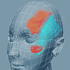 Ursachen Epilepsie Focus Epilepsie epilepsy brain gehirn gif Ursachen Focus