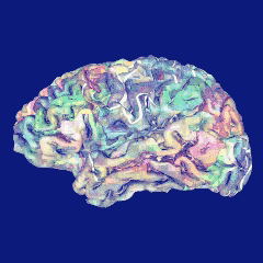 Gehirn Migräne Ursachen Gehrin Migräne brain cause Ursachen animation