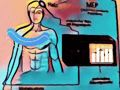 Diagnostik Parkinson MEP MEP Diagnostik Parkinson disease