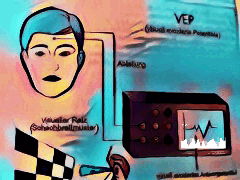 MS VEP visuell evozierte Potentiale MS VEP Untersuchung Multiple Sklerose