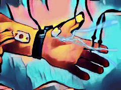 Hand Messung CTS KTS Hand Messung Neurologe Hamburg CTS KTS