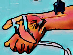 CTS Messung NLG CTS Messung NLG KTS Karpaltunnelsyndrom