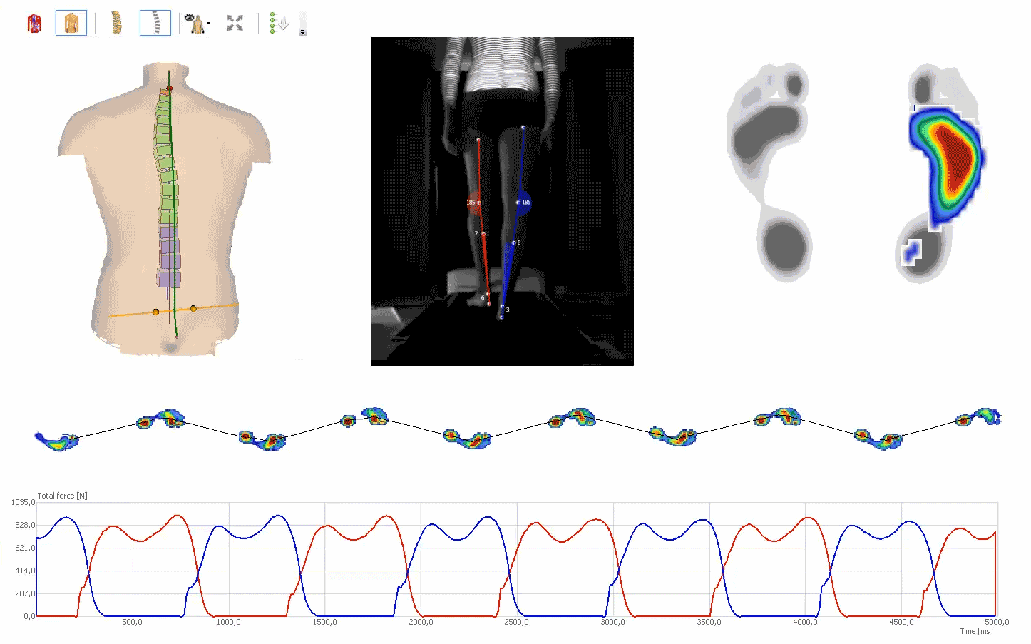 4Dmotion leg-axis pedogait