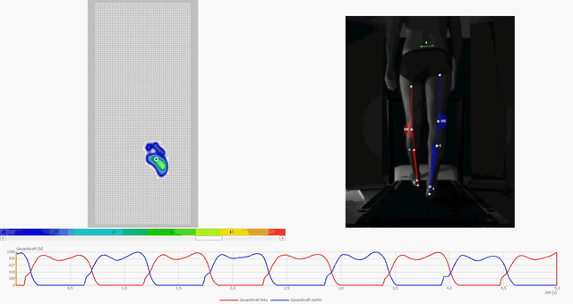 pedogait und leg-axis